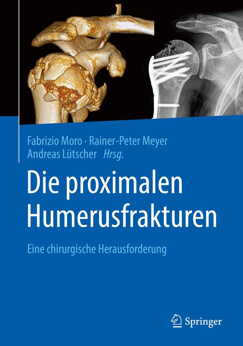 Buy Die proximalen Humerusfrakturen: Eine chirurgische Herausforderung by Fabrizio Moro, Rainer-Peter Meyer, Andreas Lütscher – Springer Hardcover German Medical Textbook — BookShops.in