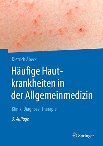 Buy Häufige Hautkrankheiten in der Allgemeinmedizin: Klinik, Diagnose, Therapie by Dietrich Abeck – Springer German Hardcover 3rd Edition 2020 – Dermatology Textbook for General Practitioners — BookShops.in