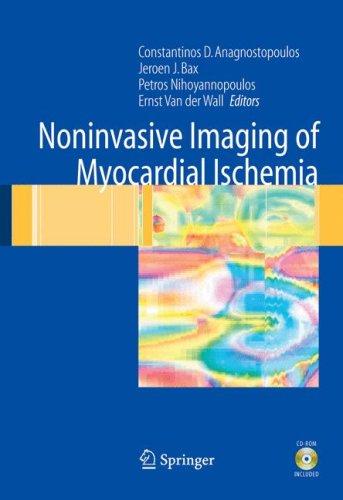 Buy Noninvasive Imaging of Myocardial Ischemia: A Guide by Anagnostopoulos, Nihoyannopoulos, Bax | Springer Verlag | Hardcover | 2006 Edition | Medicine & Health Sciences — BookShops.in