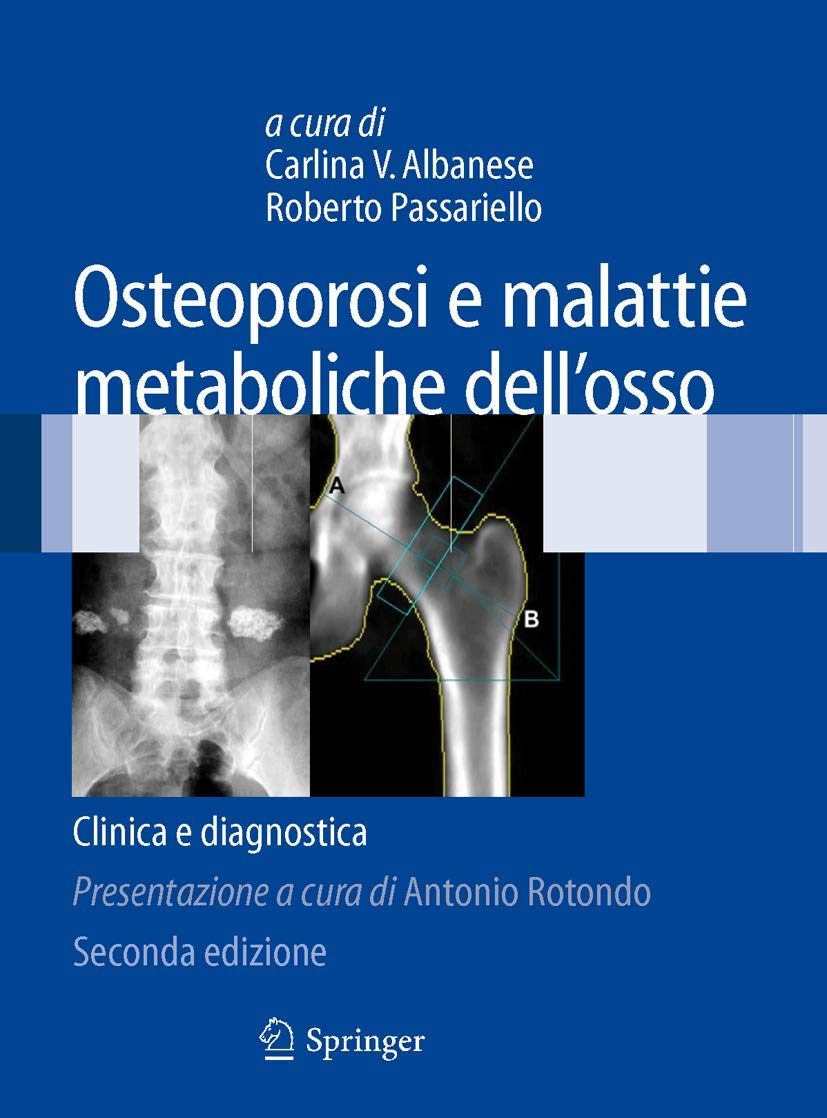 Buy Osteoporosi E Malattie Metaboliche Dell'osso: Clinica E Diagnostica by Carlina V. Albanese & Roberto Passariello - Springer Nature Italian Hardcover 2nd Edition - Radiology & Nuclear Medicine Textbook — BookShops.in