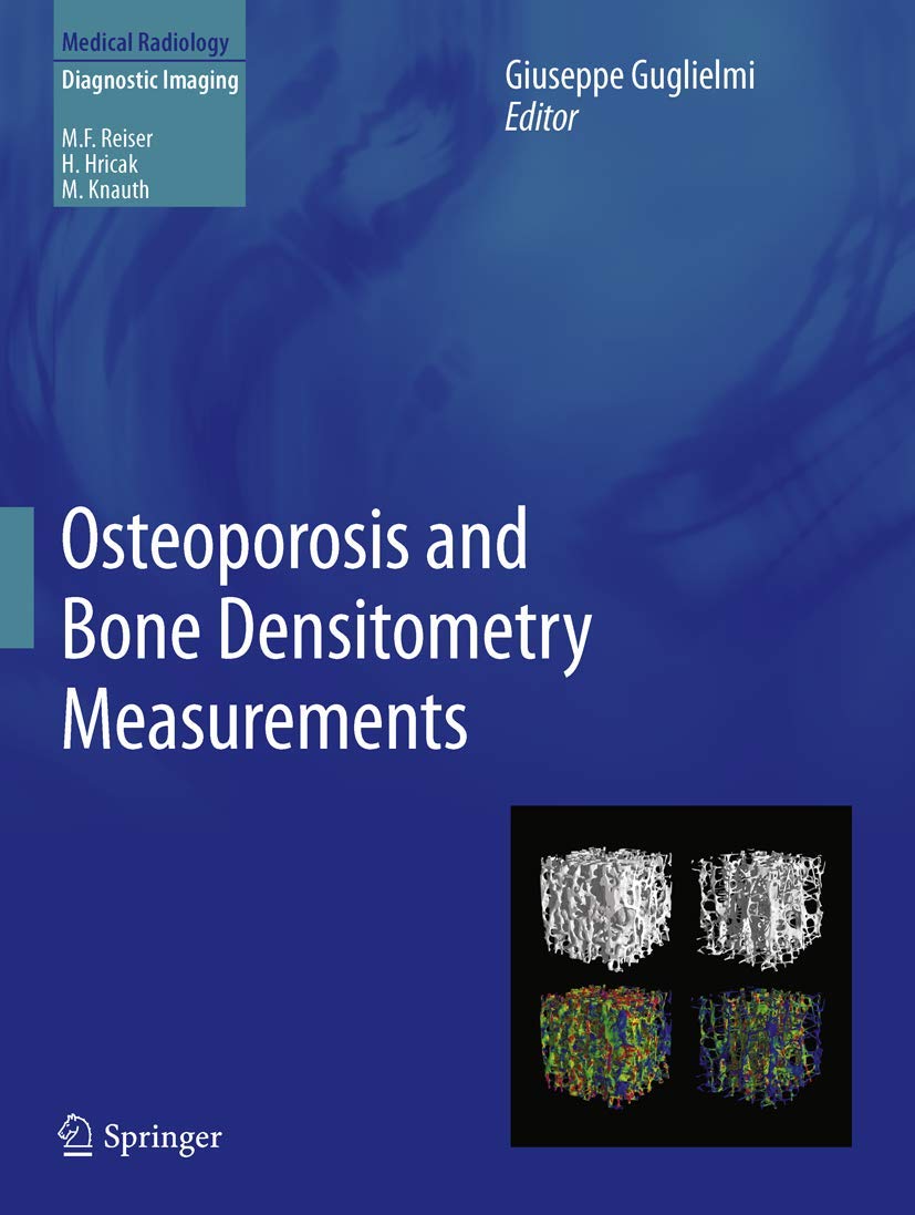 Buy Osteoporosis and Bone Densitometry Measurements by Giuseppe Guglielmi | Springer Nature | Hardcover | 2013 Edition | Radiology & Nuclear Medicine Textbook — BookShops.in