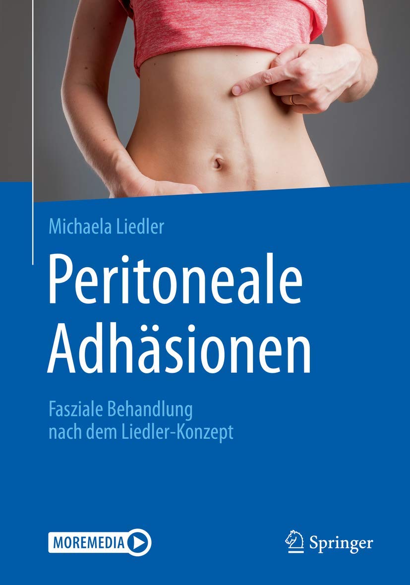 Buy Peritoneale Adhäsionen: Fasziale Behandlung nach dem Liedler-Konzept by Michaela Liedler – Springer German Hardcover 2020 Medical Textbook — BookShops.in