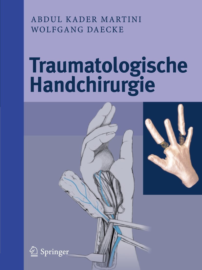 Buy Traumatologische Handchirurgie by Abdul Kader Martini & Wolfgang Daecke | Springer | German Language | Paperback | Hand Surgery Textbook — BookShops.in