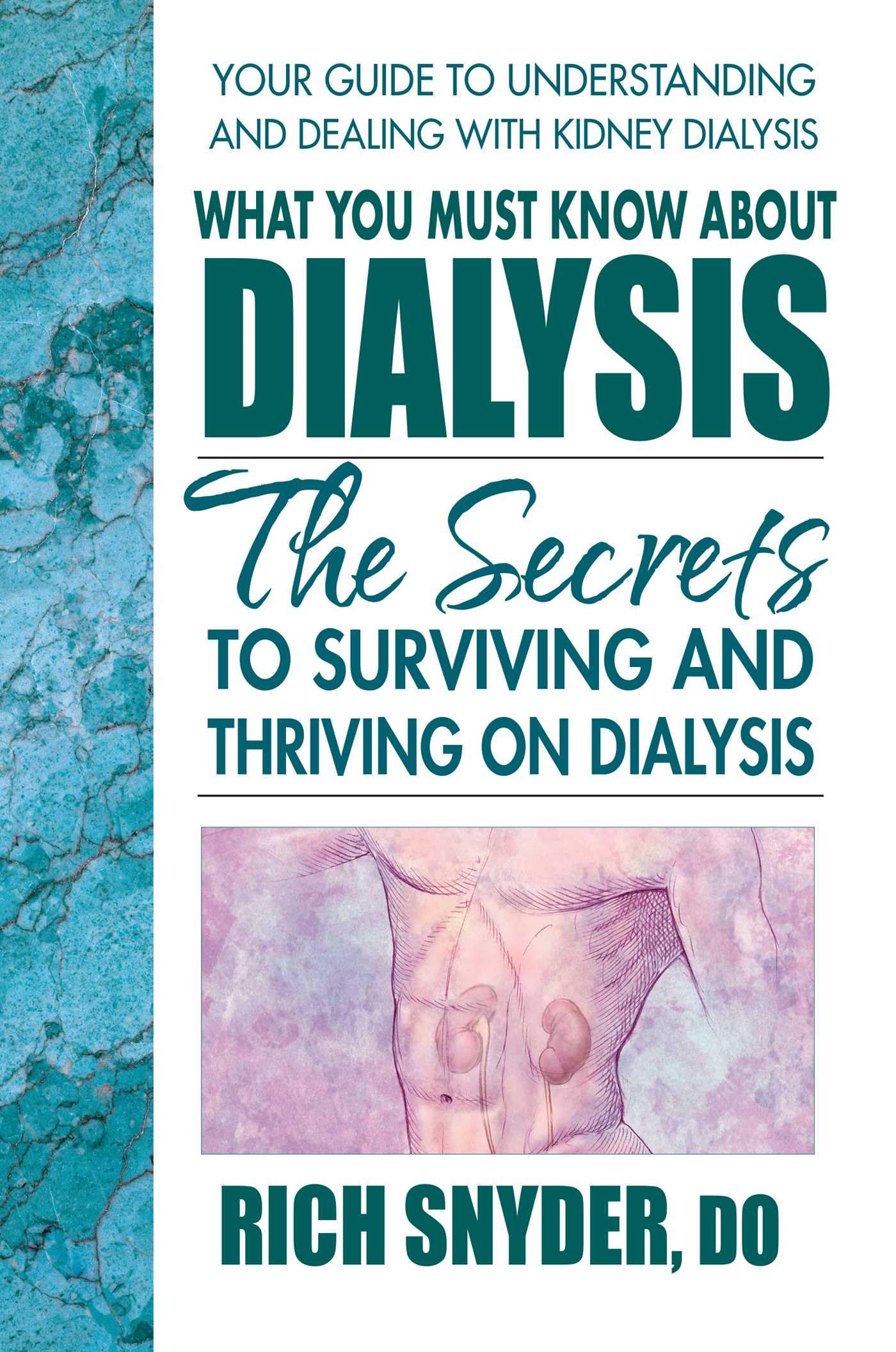 Buy What You Must Know About Dialysis by Rich Snyder: Surviving and Thriving on Dialysis – Square One Publishers, English, Paperback, 1st Edition — BookShops.in
