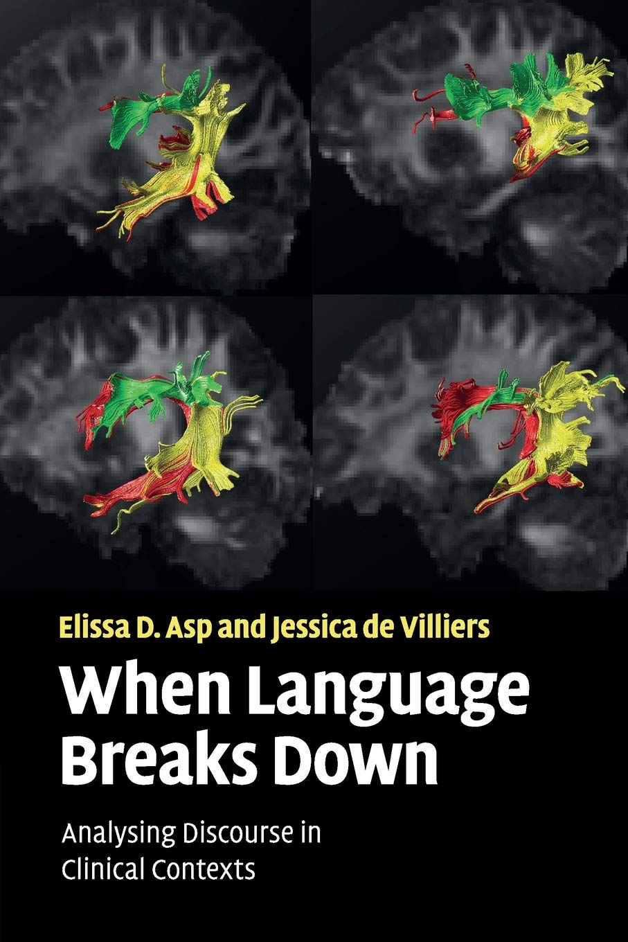 Buy When Language Breaks Down: Discourse Analysis in Alzheimer's and Autism | Elissa D. Asp, Jessica de Villiers | Cambridge University Press | Hardcover | 9780521718240 — BookShops.in