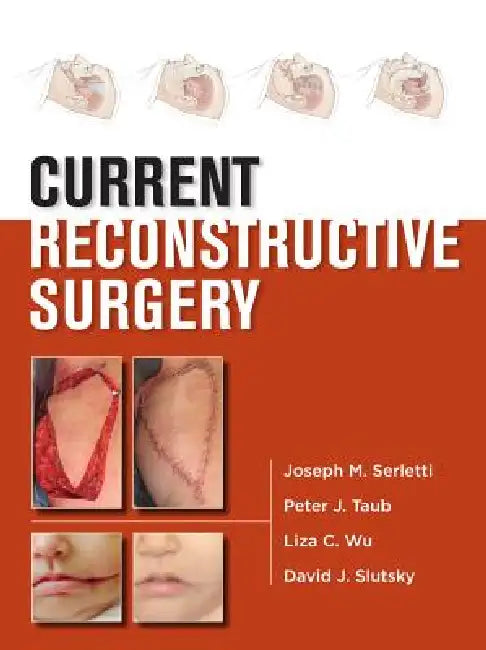 Current Reconstructive Surgery (English, Joseph M. Serletti | Peter J. Taub | Liza Wu)