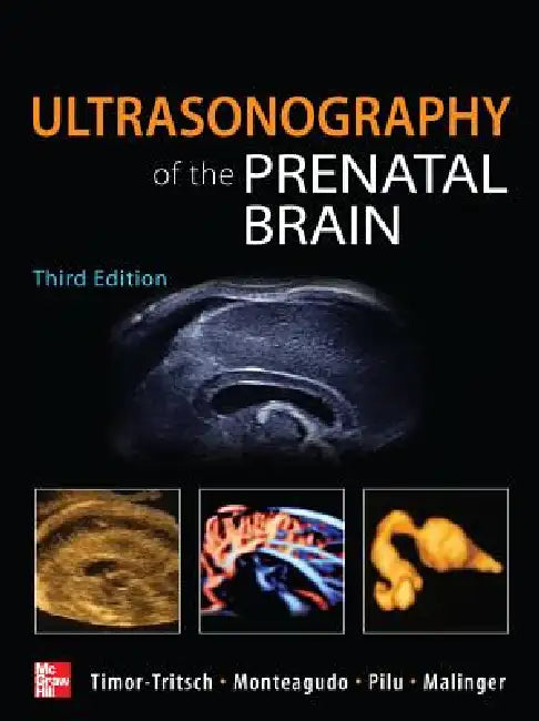 Ultrasonography of the Prenatal Brain (English, Ilan Timor-Tritsch | Ana Monteagudo | Gianluigi Pilu)