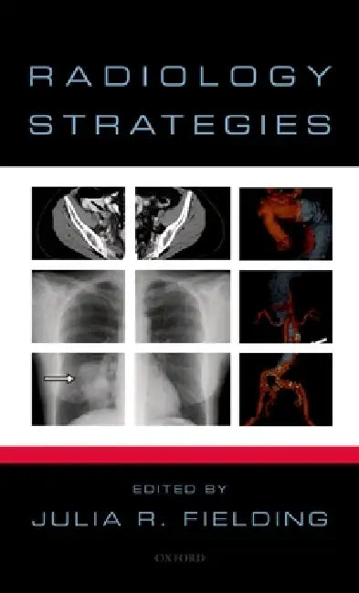 Radiology Strategies (English, Julia Fielding)