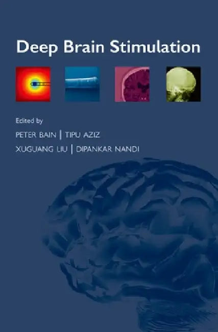 Deep Brain Stimulation (English, Peter Bain | Tipu Aziz | Xuguang Liu)