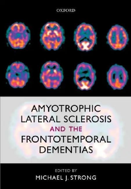 Amyotrophic Lateral Sclerosis and the Frontotemporal Dementias (English, Michael J. Strong)