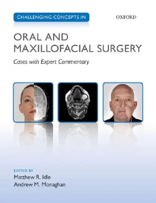 Buy Challenging Concepts in Oral and Maxillofacial Surgery | by Matthew Idle | Andrew Monaghan | Oxford University Press | by Matthew Idle | Andrew Monaghan | Oxford University Press | by Matthew Idle | Andrew Monaghan | Oxford University Press | by Matthew Idle | Andrew Monaghan | Oxford University Press | by Matthew Idle | Andrew Monaghan | Oxford University Press | by Matthew Idle | Andrew Monaghan | Oxford University Press | by Matthew Idle | Andrew Monaghan | Oxford University Press | by Matthe — BookShops.in