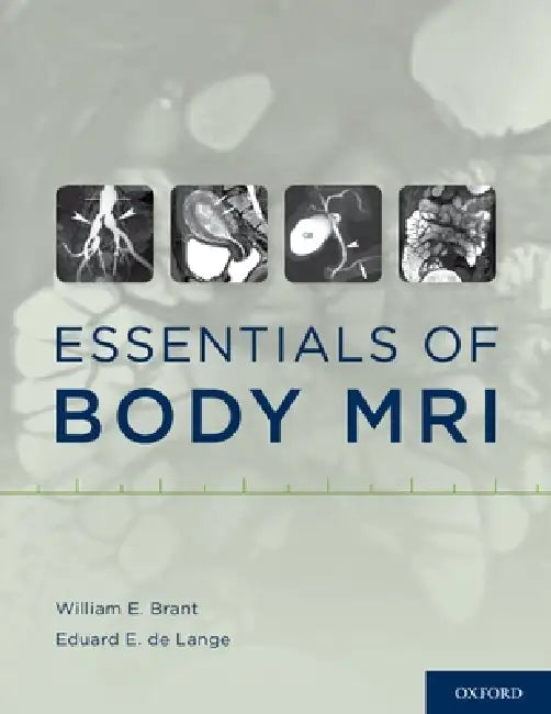 Essentials of Body MRI (English, William E. Brant | Eduard E. de Lange)