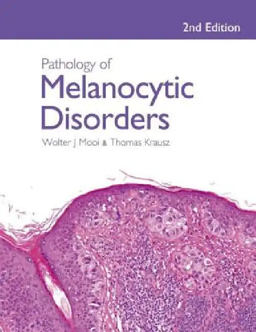 Pathology of Melanocytic Disorders 2ed (English, Walter Mooi | Thomas Krausz)