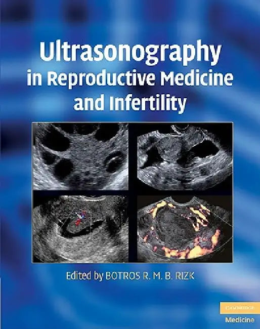 Buy Ultrasonography in Reproductive Medicine and Infertility | by Botros R. M. B. Rizk | Cambridge University Press | by Botros R. M. B. Rizk | Cambridge University Press | by Botros R. M. B. Rizk | Cambridge University Press | by Botros R. M. B. Rizk | Cambridge University Press | by Botros R. M. B. Rizk | Cambridge University Press | by Botros R. M. B. Rizk | Cambridge University Press | by Botros R. M. B. Rizk | Cambridge University Press | by Botros R. M. B. Rizk | Cambridge University Press | b — BookShops.in