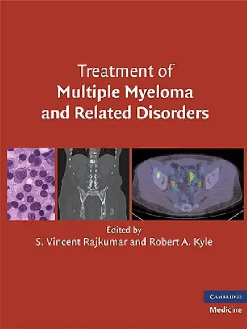 Treatment of Multiple Myeloma and Related Disorders (English, S. Vincent Rajkumar | Robert A. Kyle)