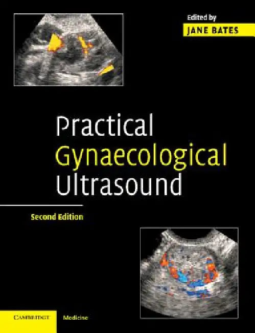 Buy Practical Gynaecological Ultrasound (English, Jane Bates) — BookShops.in