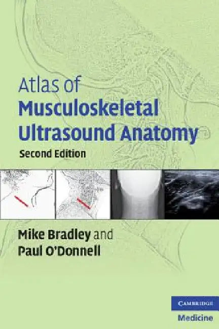 Buy Atlas of Musculoskeletal Ultrasound Anatomy | by Mike Bradley | Paul O'Donnell | Cambridge University Press | by Mike Bradley | Paul O'Donnell | Cambridge University Press | by Mike Bradley | Paul O'Donnell | Cambridge University Press | by Mike Bradley | Paul O'Donnell | Cambridge University Press | by Mike Bradley | Paul O'Donnell | Cambridge University Press | by Mike Bradley | Paul O'Donnell | Cambridge University Press | by Mike Bradley | Paul O'Donnell | Cambridge University Press | by Mik — BookShops.in