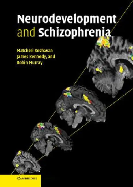 Buy Neurodevelopment and Schizophrenia (English, Robin Murray | Matcheri Keshavan | James Kennedy) — BookShops.in