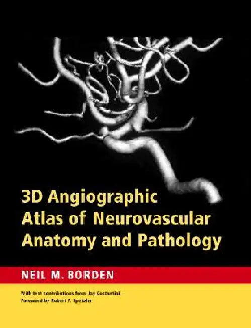 Buy 3D Angiographic Atlas of Neurovascular Anatomy and Pathology | by Neil M. Borden | Cambridge University Press | by Neil M. Borden | Cambridge University Press | by Neil M. Borden | Cambridge University Press | by Neil M. Borden | Cambridge University Press | by Neil M. Borden | Cambridge University Press | by Neil M. Borden | Cambridge University Press | by Neil M. Borden | Cambridge University Press | by Neil M. Borden | Cambridge University Press | by Neil M. Borden | Cambridge University Pres — BookShops.in