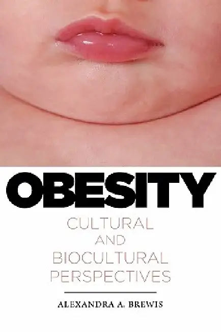 Obesity (English, Alexandra a. Brewis)
