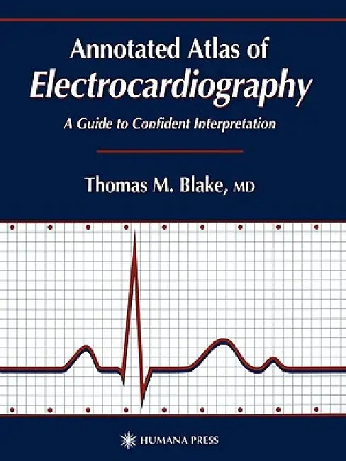 Buy Annotated Atlas of Electrocardiography (English, Thomas M. Blake) — BookShops.in