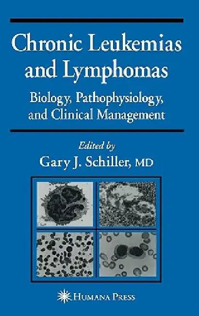 Chronic Leukemias and Lymphomas (English, Gary J. Schiller)
