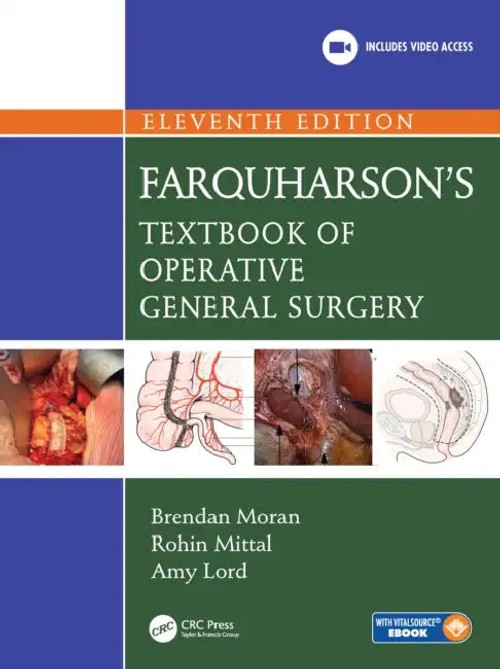 Farquharson's Textbook of Operative General Surgery – Moran Brendan view 2