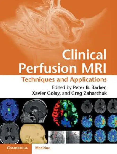 Clinical Perfusion MRI (English, Peter B. Barker | Xavier Golay | Gregory Zaharchuk)