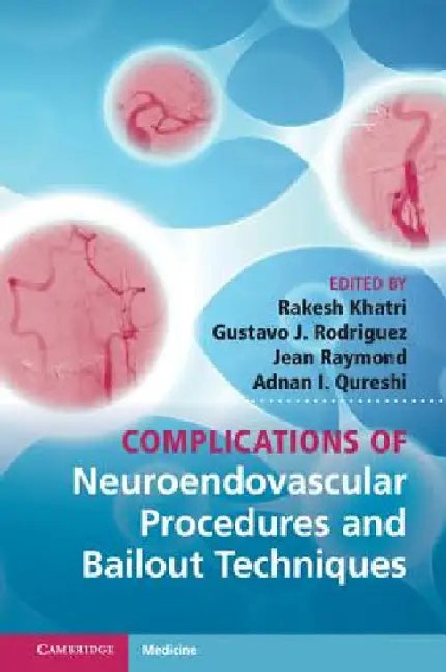 Complications of Neuroendovascular Procedures and Bailout Techniques – Rakesh Khatri view 2