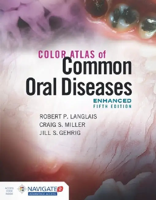 Buy Color Atlas of Common Oral Diseases, Enhanced Edition | by Robert P. Langlais | Craig S. Miller | Jill S. Gehrig | Jones &amp; Bartlett Publishers | by Robert P. Langlais | Craig S. Miller | Jill S. Gehrig | Jones &amp; Bartlett Publishers | by Robert P. Langlais | Craig S. Miller | Jill S. Gehrig | Jones &amp; Bartlett Publishers | by Robert P. Langlais | Craig S. Miller | Jill S. Gehrig | Jones &amp; Bartlett Publishers | by Robert P. Langlais | Craig S. Miller | Jill S. Gehrig | Jones &amp; B — BookShops.in