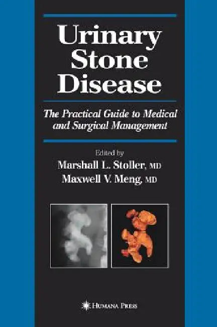 Buy Urinary Stone Disease (English, Marshall L. Stoller | Maxwell V. Meng) — BookShops.in