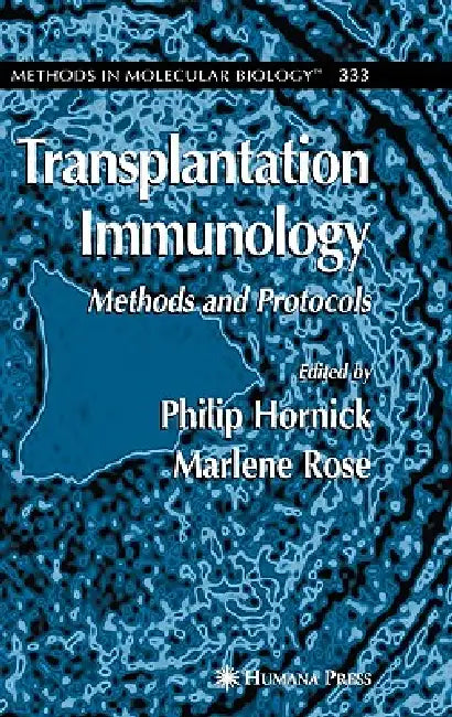Transplantation Immunology (English, Philip Hornick)