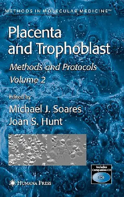 Placenta and Trophoblast (English, Michael J. Soares | Joan S. Hunt)