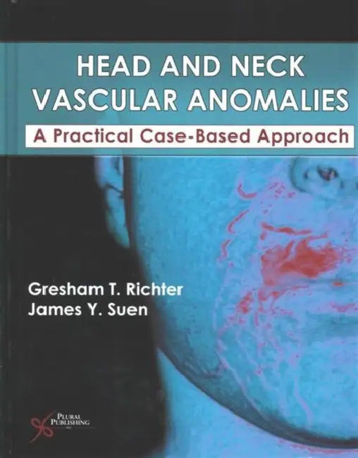 Buy Head and Neck Vascular Anomalies (English, Gresham T. Richter) — BookShops.in