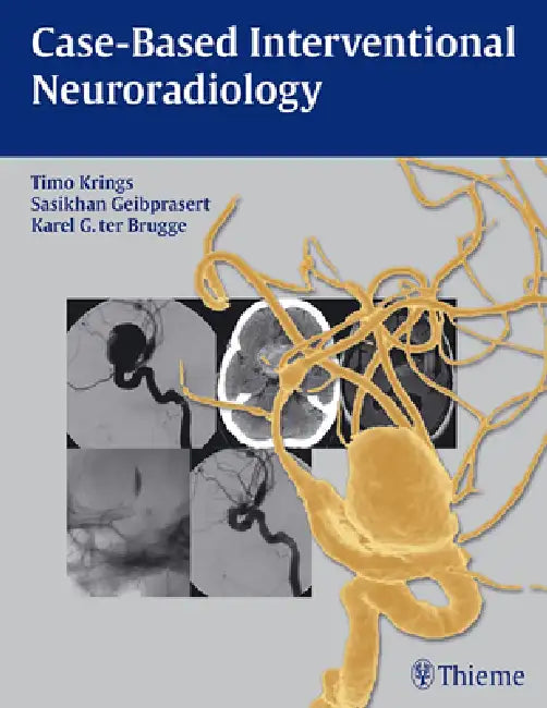 Buy Case-Based Interventional Neuroradiology [With Access Code] (English, Timo Krings | Sasikhan Geibprasert | Karel Ter Brugge) — BookShops.in