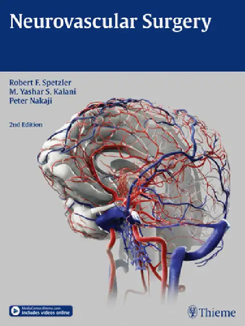 Neurovascular Surgery (English, Robert F. Spetzler | M. Yashar Kalani | Peter Nakaji)