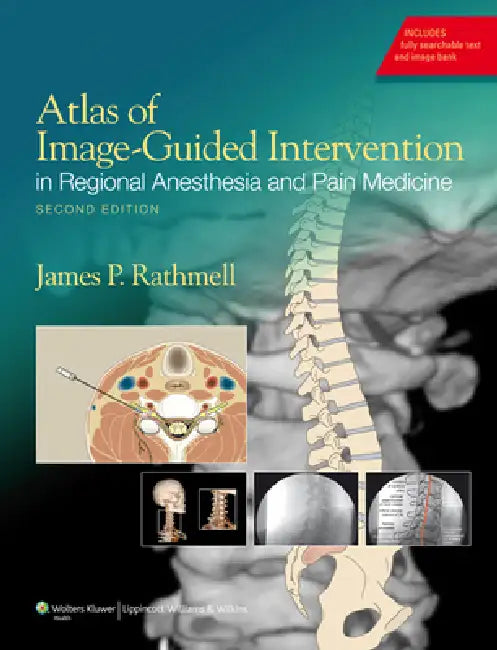 Buy Atlas of Image-Guided Intervention in Regional Anesthesia and Pain Medicine (English, James P. Rathmell) — BookShops.in