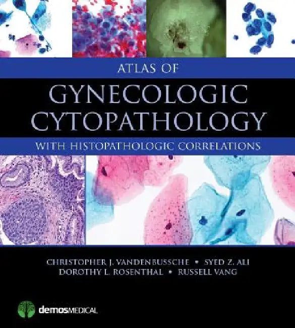 Buy Atlas of Gynecologic Cytopathology | by Christopher J. Vandenbussche | Syed Z. Ali | Dorothy L. Rose | Demos Medical Publishing | by Christopher J. Vandenbussche | Syed Z. Ali | Dorothy L. Rose | Demos Medical Publishing | by Christopher J. Vandenbussche | Syed Z. Ali | Dorothy L. Rose | Demos Medical Publishing | by Christopher J. Vandenbussche | Syed Z. Ali | Dorothy L. Rose | Demos Medical Publishing | by Christopher J. Vandenbussche | Syed Z. Ali | Dorothy L. Rose | Demos Medical Publishing  — BookShops.in