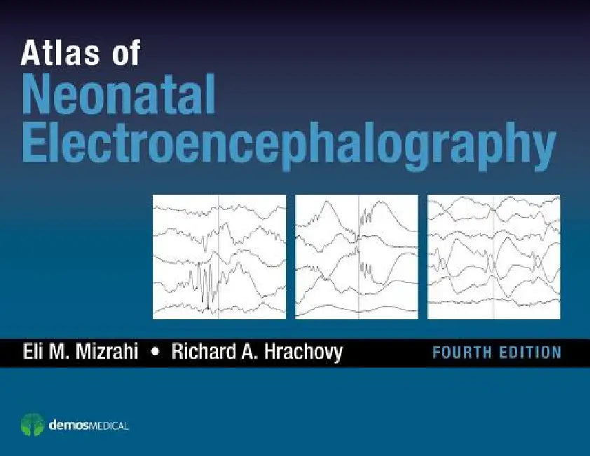 Buy Atlas of Neonatal Electroencephalography (English, Eli M. Mizrahi | Richard A. Hrachovy) — BookShops.in