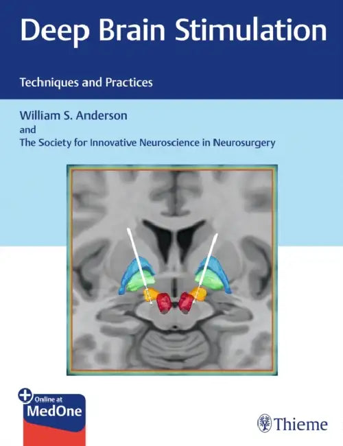 Buy Deep Brain Stimulation (English, William S. Anderson | The Society for Innovative Neuroscience) — BookShops.in