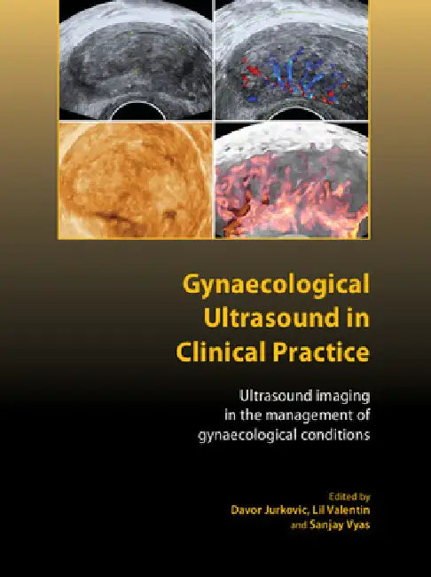 Buy Gynaecological Ultrasound in Clinical Practice | by Davor Jurkovic | Lil Valentin | Sanjay Vyas | Royal College of Obstetricians and Gynecologi | by Davor Jurkovic | Lil Valentin | Sanjay Vyas | Royal College of Obstetricians and Gynecologi | by Davor Jurkovic | Lil Valentin | Sanjay Vyas | Royal College of Obstetricians and Gynecologi | by Davor Jurkovic | Lil Valentin | Sanjay Vyas | Royal College of Obstetricians and Gynecologi | by Davor Jurkovic | Lil Valentin | Sanjay Vyas | Royal College  — BookShops.in