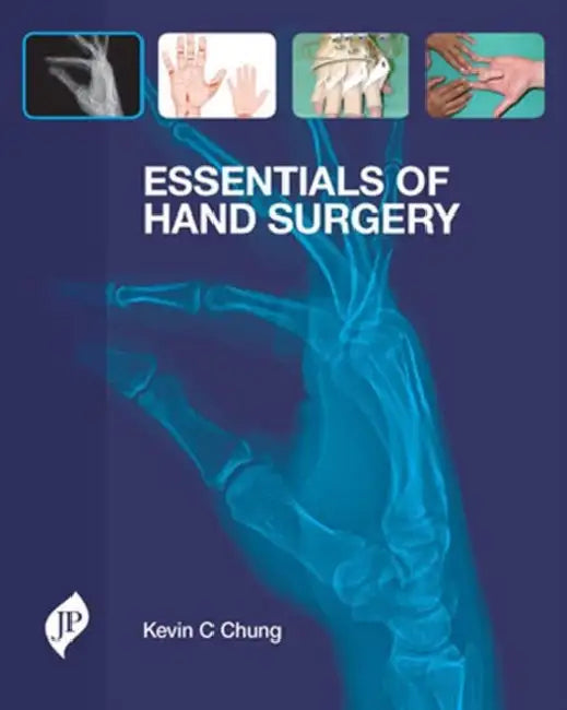 Buy Essentials Of Hand Surgery (English, Kevin C Chung) — BookShops.in