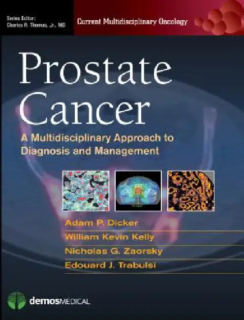 Prostate Cancer (English, Adam P. Dicker | William Kevin Kelly | Nicholas G. Zaorsky)