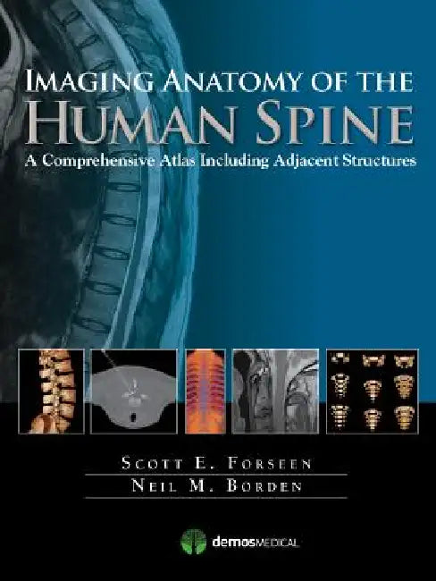 Buy Imaging Anatomy of the Human Spine (English, Scott E. Forseen | Neil M. Borden) — BookShops.in