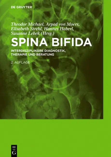Buy Spina Bifida (English, Theodor Michael) — BookShops.in