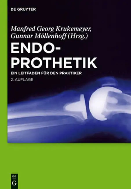 Buy Endoprothetik (English, Manfred Georg Krukemeyer) — BookShops.in