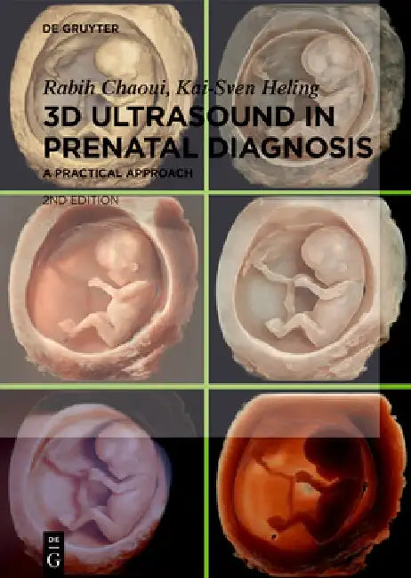 3D Ultrasound in Prenatal Diagnosis (English, Rabih Chaoui)