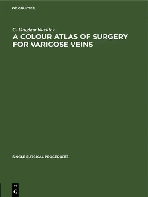 Buy A Colour Atlas of Surgery for Varicose Veins (English, C. Vaughan Ruckley) — BookShops.in