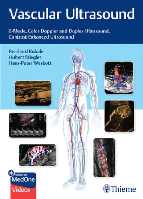 Buy Vascular Ultrasound (English, Reinhard Kubale | Hubert Stiegler | Hans-Peter Weskott) — BookShops.in