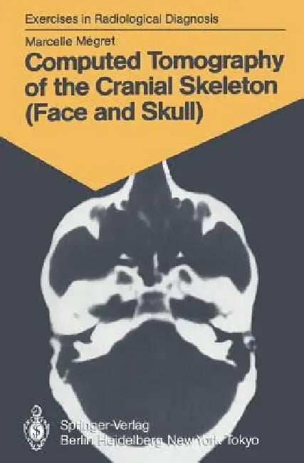 Buy Computed Tomography of the Cranial Skeleton (Face and Skull) (English, Marcelle Megret | Marie-Therese Wackenheim) — BookShops.in